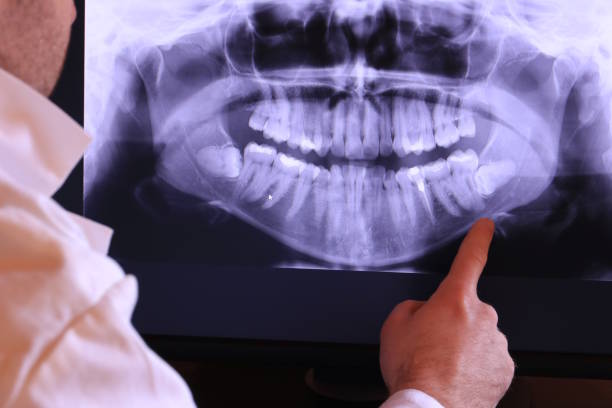 Best Urgent Care for Lost Fillings or Crowns in South Brooksville, FL