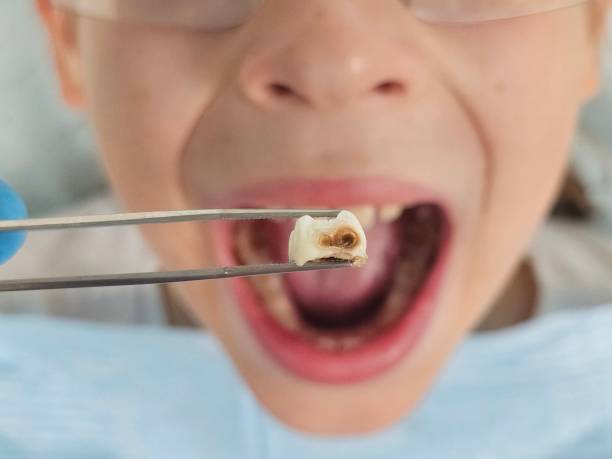 Best Pediatric Emergency Dentist in South Brooksville, FL